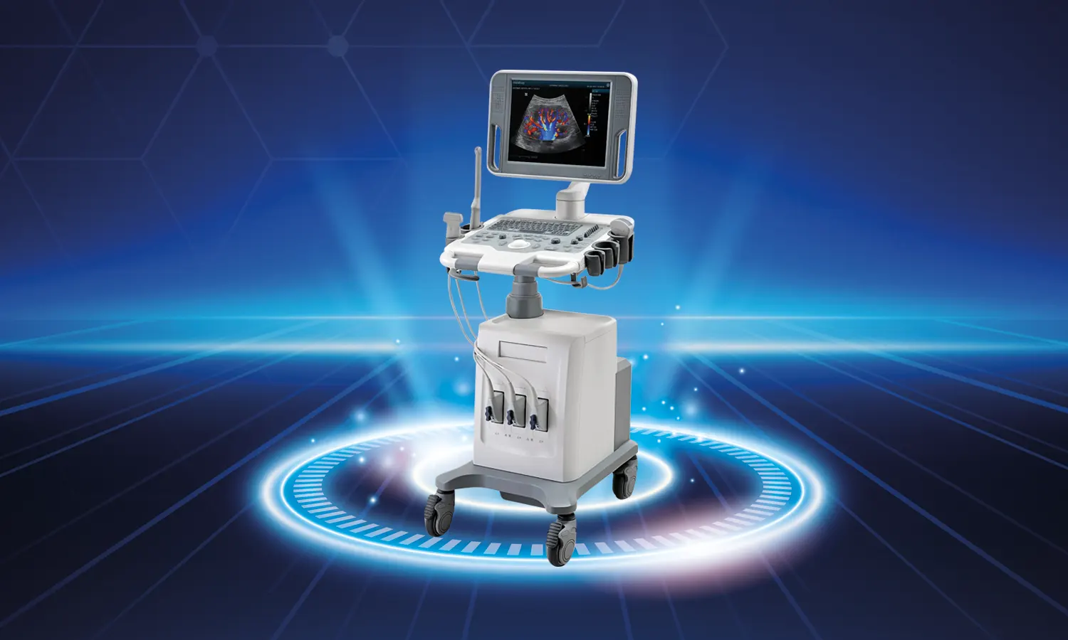 İleri Düzey Ultrasonografi Ve Fetal Tedavi