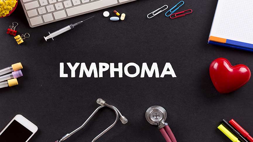 Lymph Cancer Treatment Options