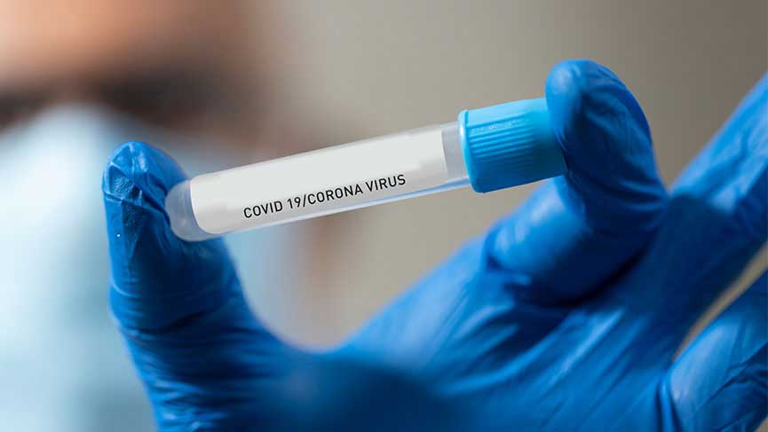 Covid 19 Aşısı