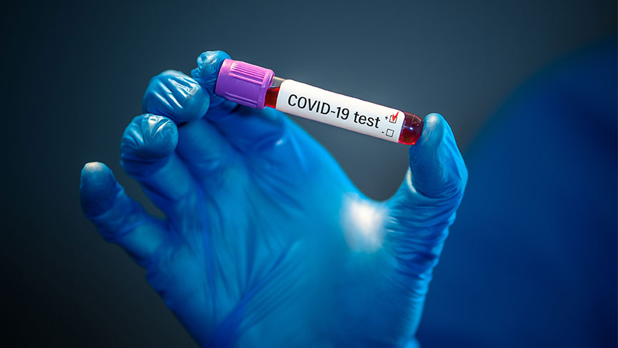 covid 19 antikor testi koru hastanesi antikor testi