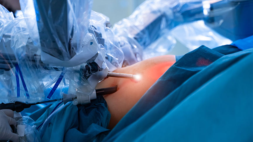 Kadın Hastalıklarında Da Vinci Robotik Cerrahi 