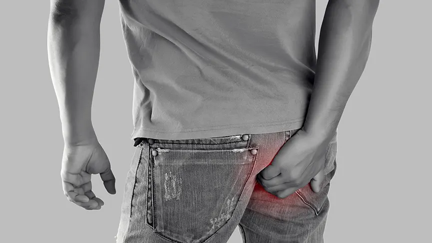 Anal Fissure: Causes, Symptoms, Treatment