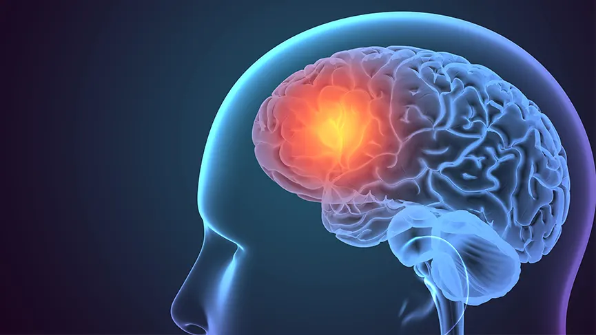 Beyin Pili Nedir?