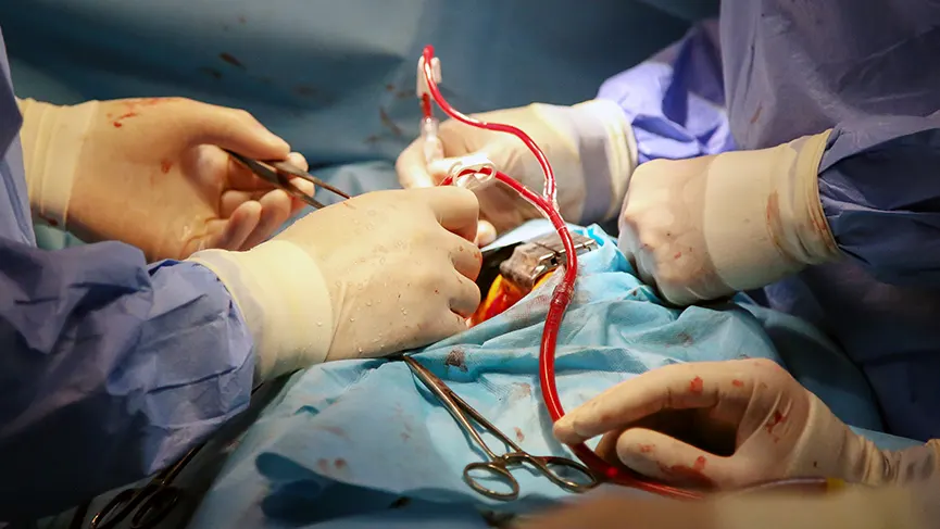 Bypass In The Working Heart