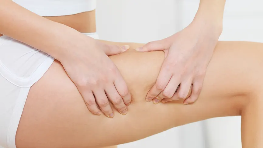 Cellulite Treatment for Women - How To Treat Cellulite Naturally
