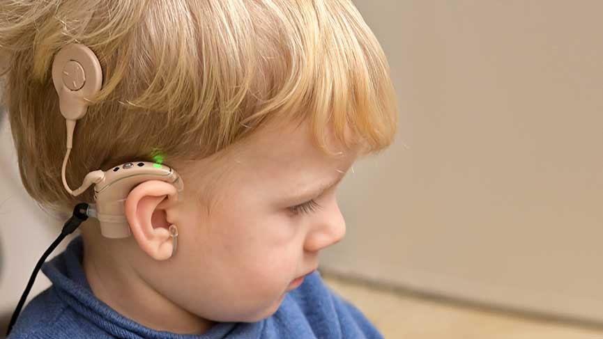 Cochlear Implant Treatment