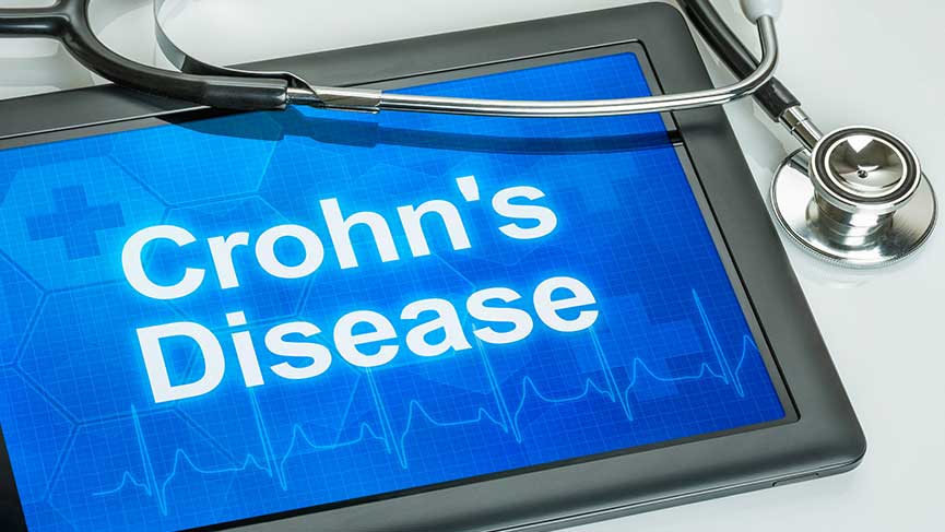 Crohn Hastalığı Nedir?