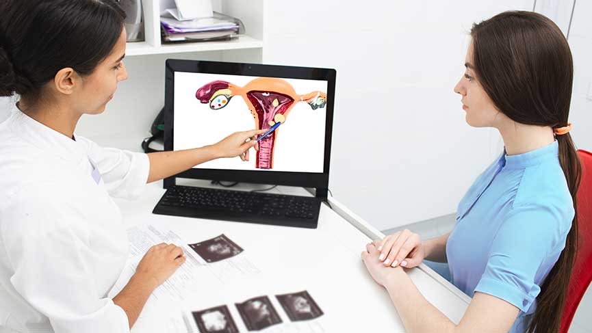 Endometriozis (Çikolata Kisti) Nedir?