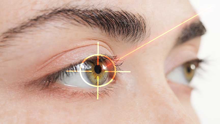 Lazer ile Göz Ameliyatı Nedir?