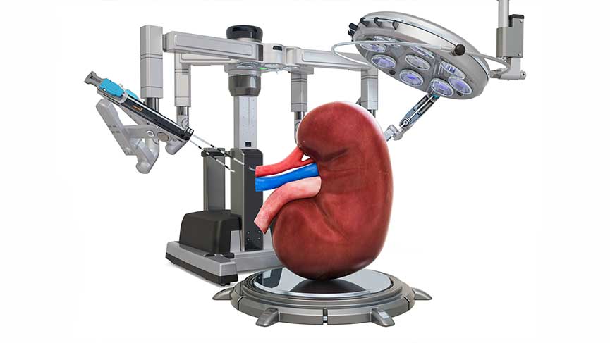 Robotik Cerrahi ile Böbrek Tümörü Ameliyatı