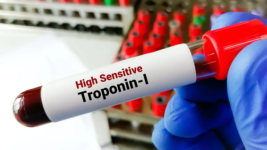 Troponin Nedir? Değeri Kaç Olmalı?