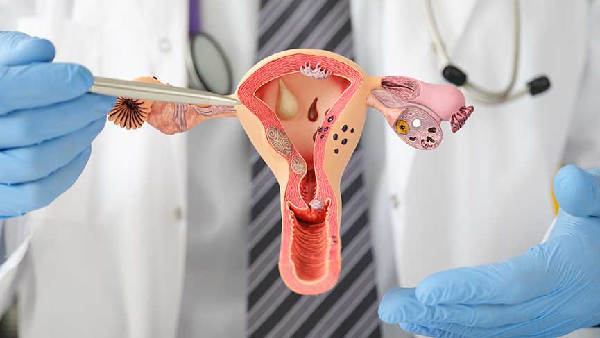 Vulva (Dış Genital Bölge) Kanseri Nedir?