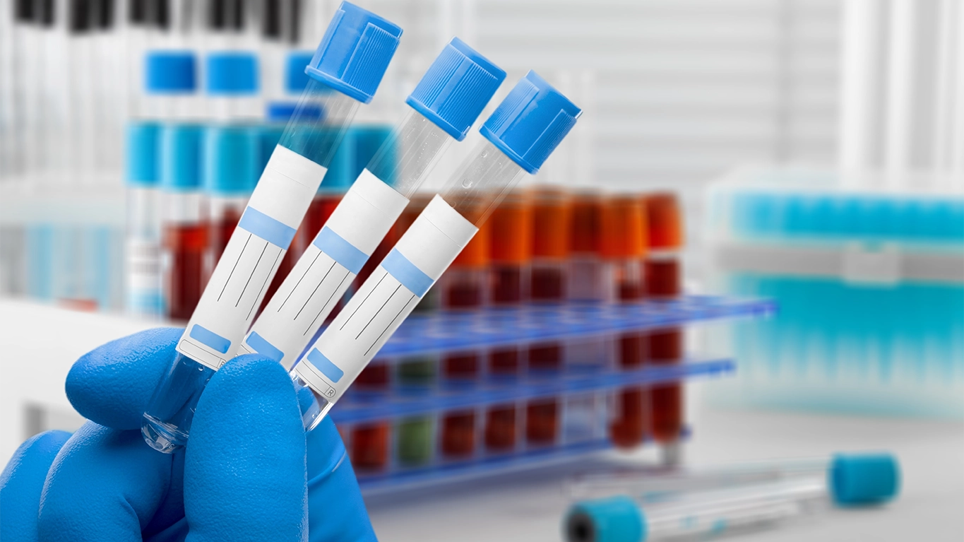 What is a Complete Blood Count Test?
