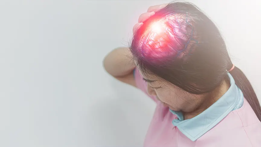 What is a Stroke?