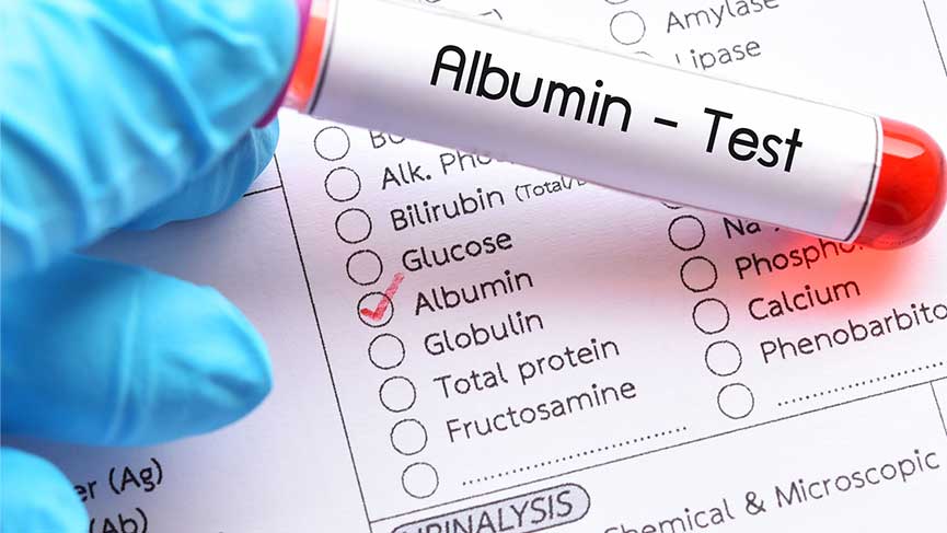 What Is Albumin?
