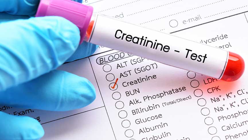 What Is Creatinine? 