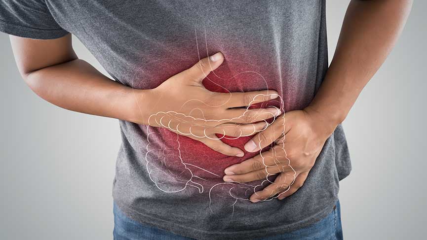 What Is Irritable Bowel Syndrome?