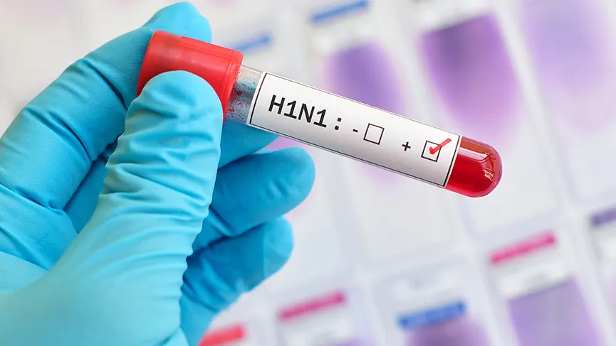 What Is Swine Flu?