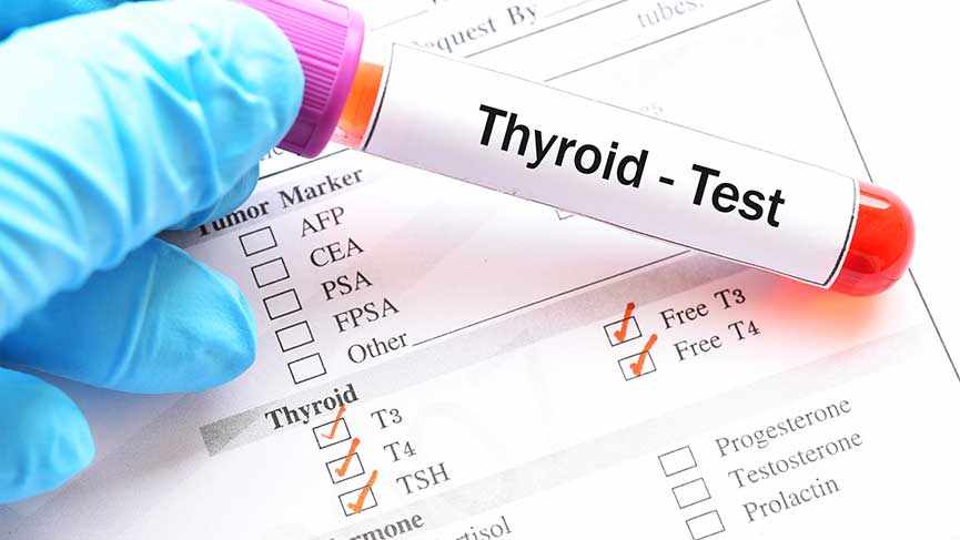 What Is Thyroid Stimulating Hormonetest?